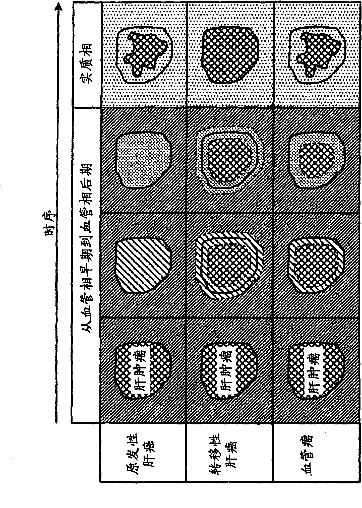 Medical image processing apparatus and ultrasonic imaging apparatus