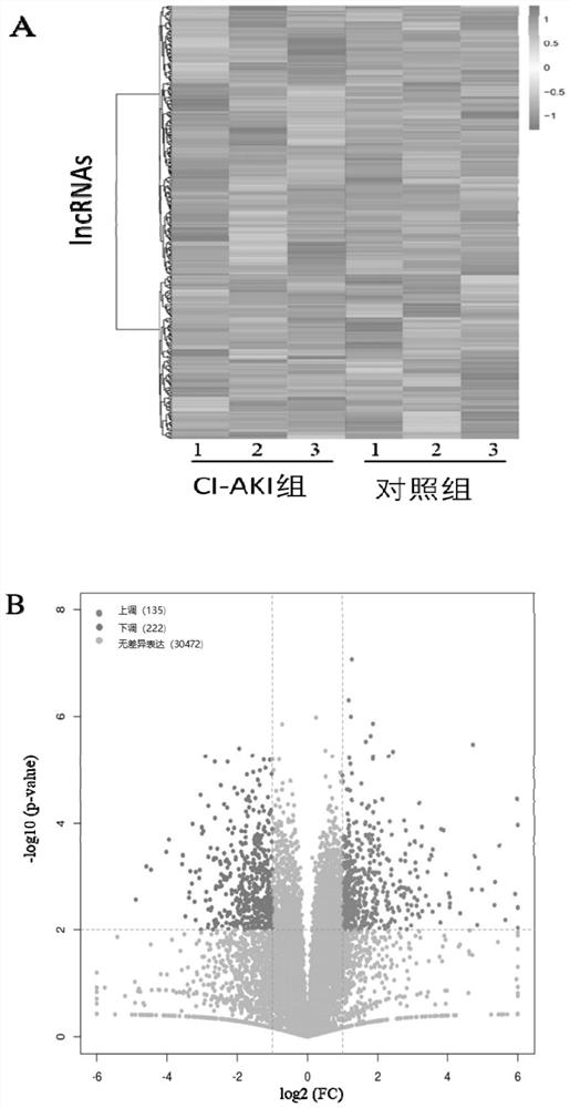 Application of long-chain non-coding RNA as biomarker to diagnosis of contrast-induced acute kidney injury (CI-AKI)