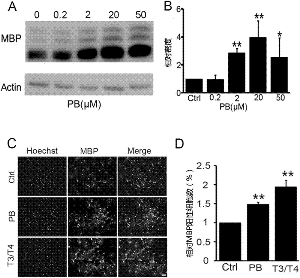 Application of pinocembrin to preparation of medicines for treating demyelination diseases