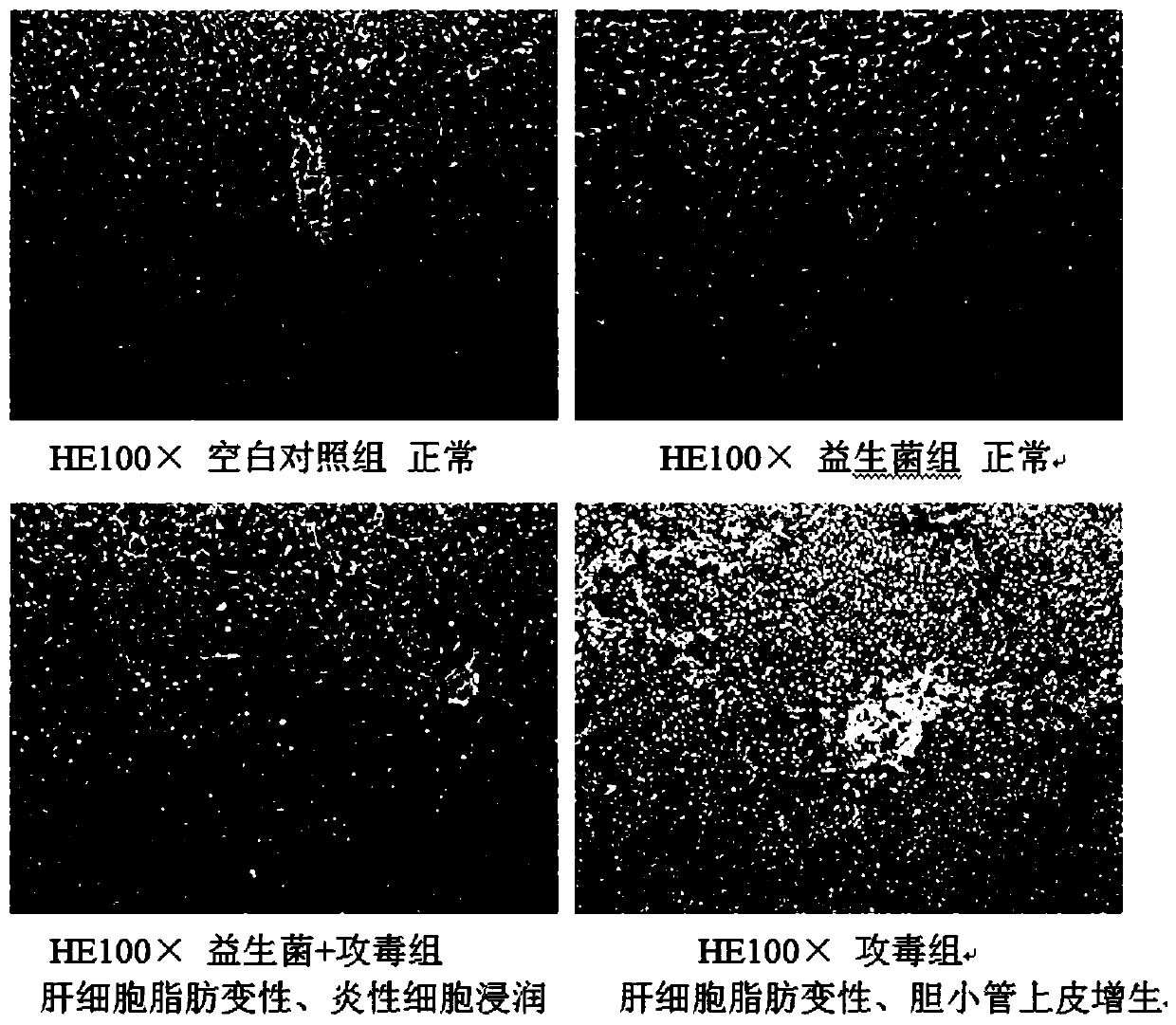 A kind of Bacillus subtilis producing aflatoxin b1 degrading enzyme and its application