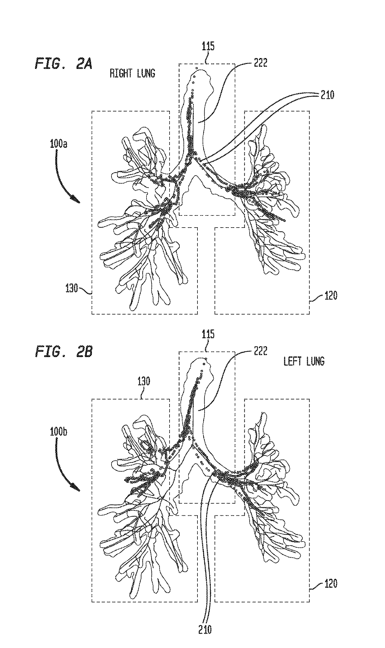 Multi-rigid registration of magnetic navigation to a computed tomography volume