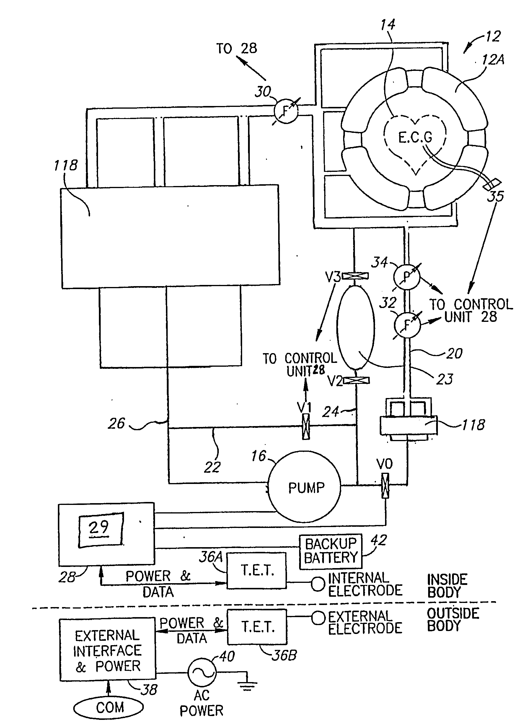 Organ Assist System and Method