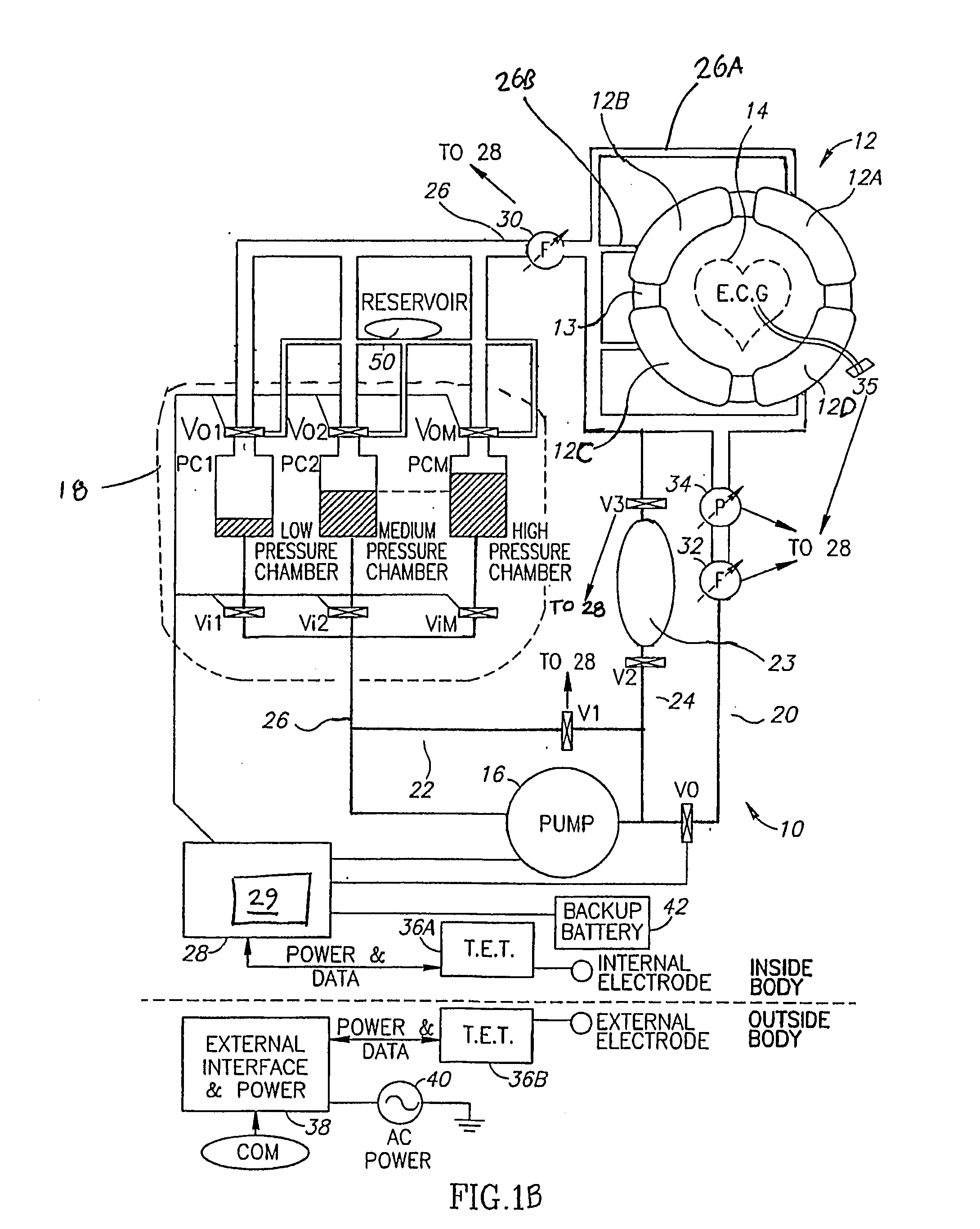 Organ Assist System and Method