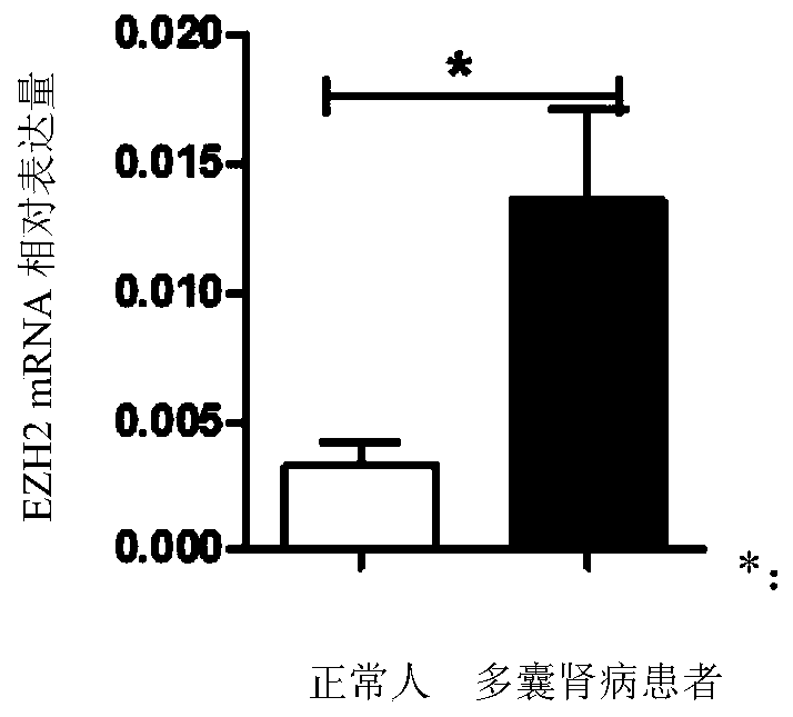 Application of EZH2 (enhancer of zeste homolog 2) in preparation of drugs to prevent or treat polycystic kidney disease