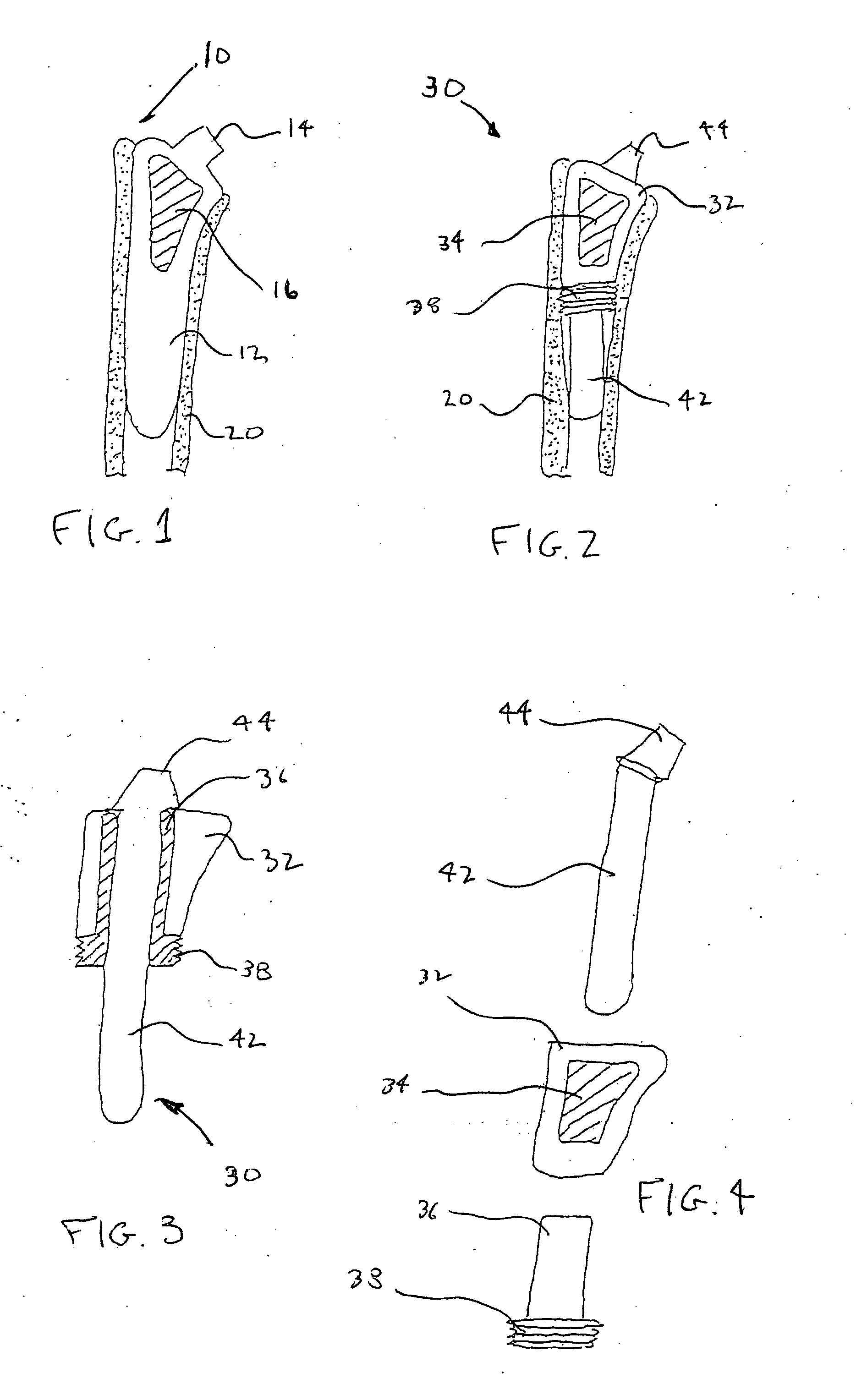 Arthroplasty devices configured to reduce shear stress