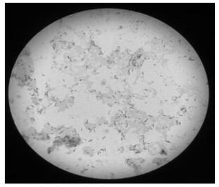 Liquid nattokinase fermentation method