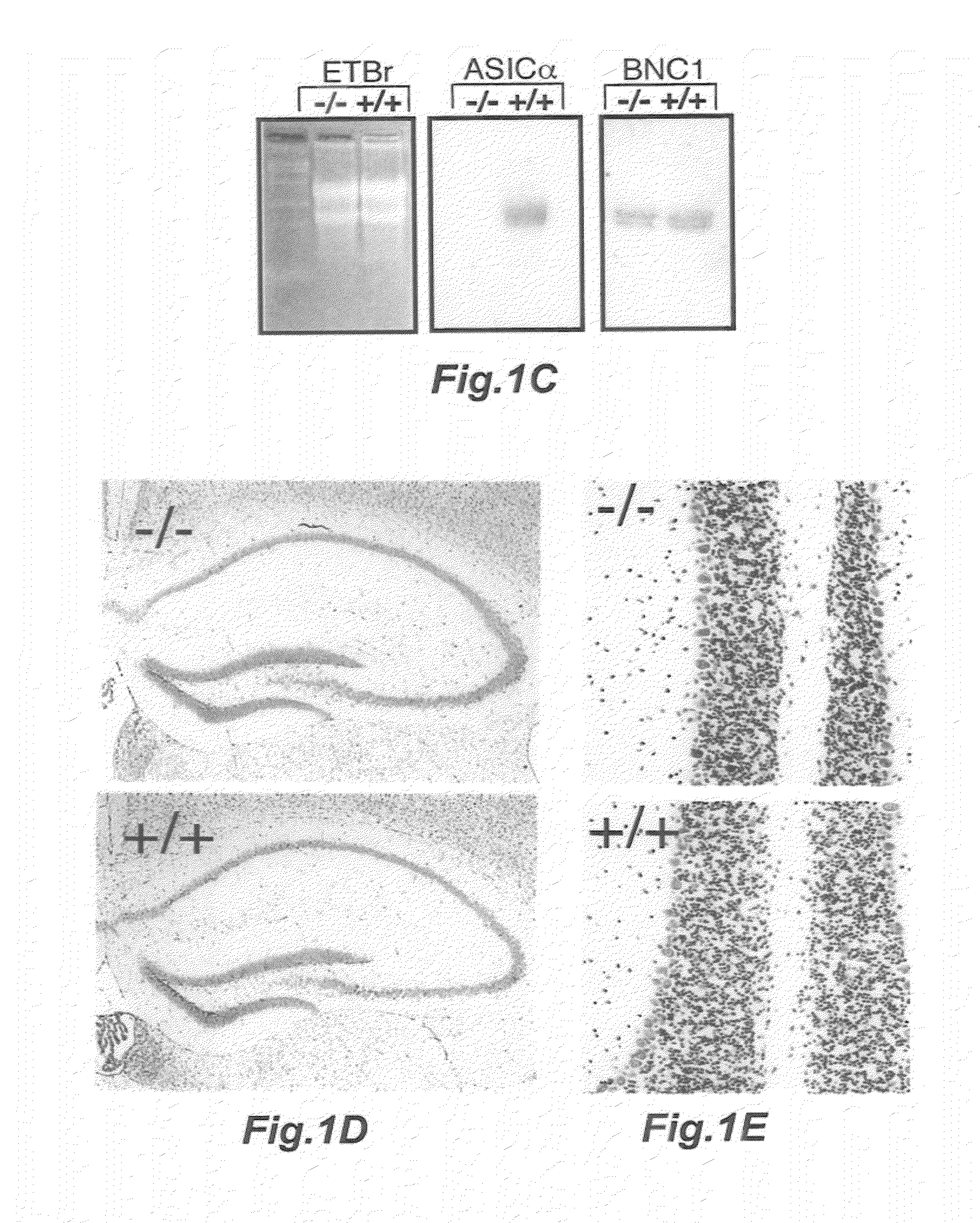 Compositions and methods for modulating the acid-sensing ion channel (ASIC)