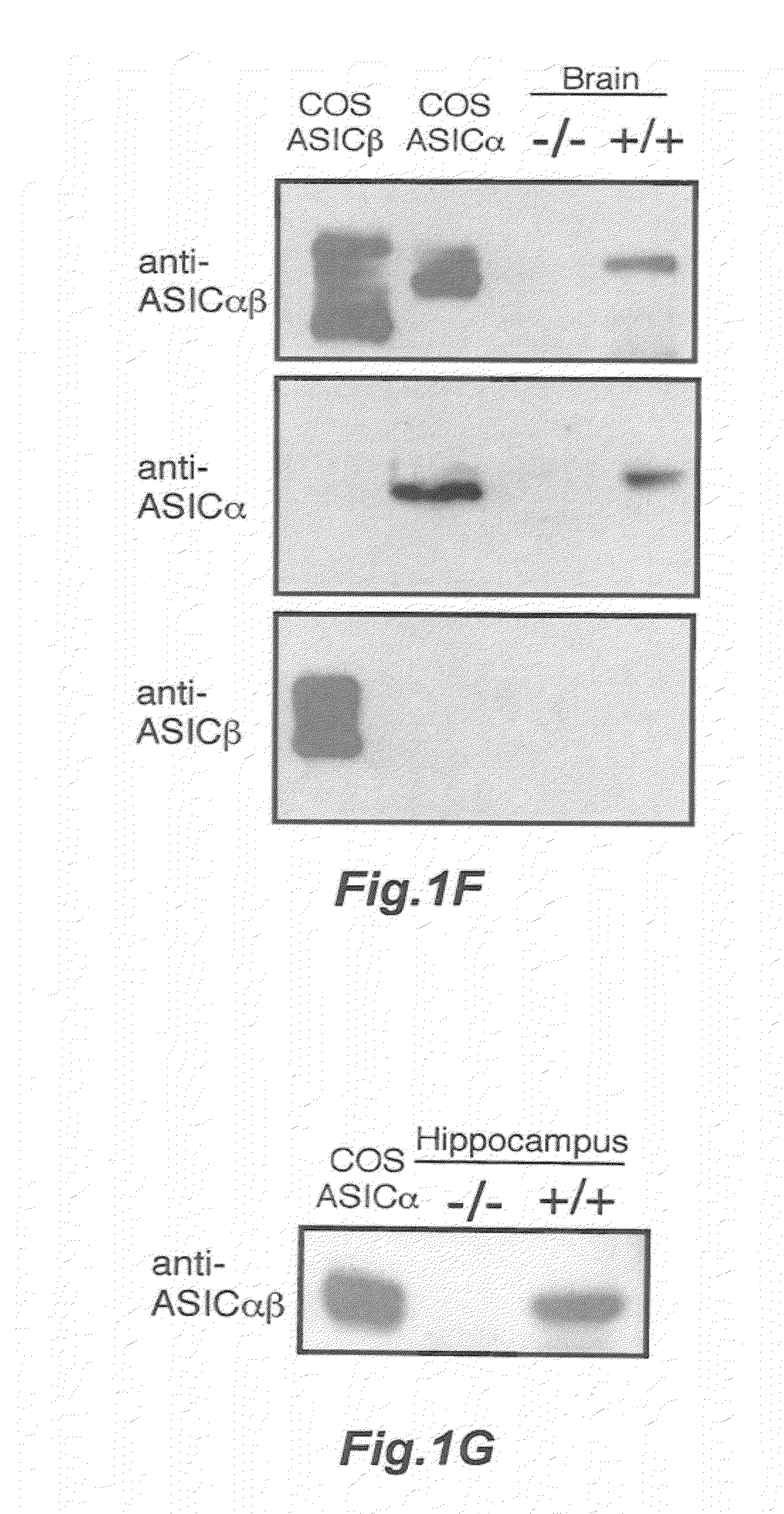 Compositions and methods for modulating the acid-sensing ion channel (ASIC)