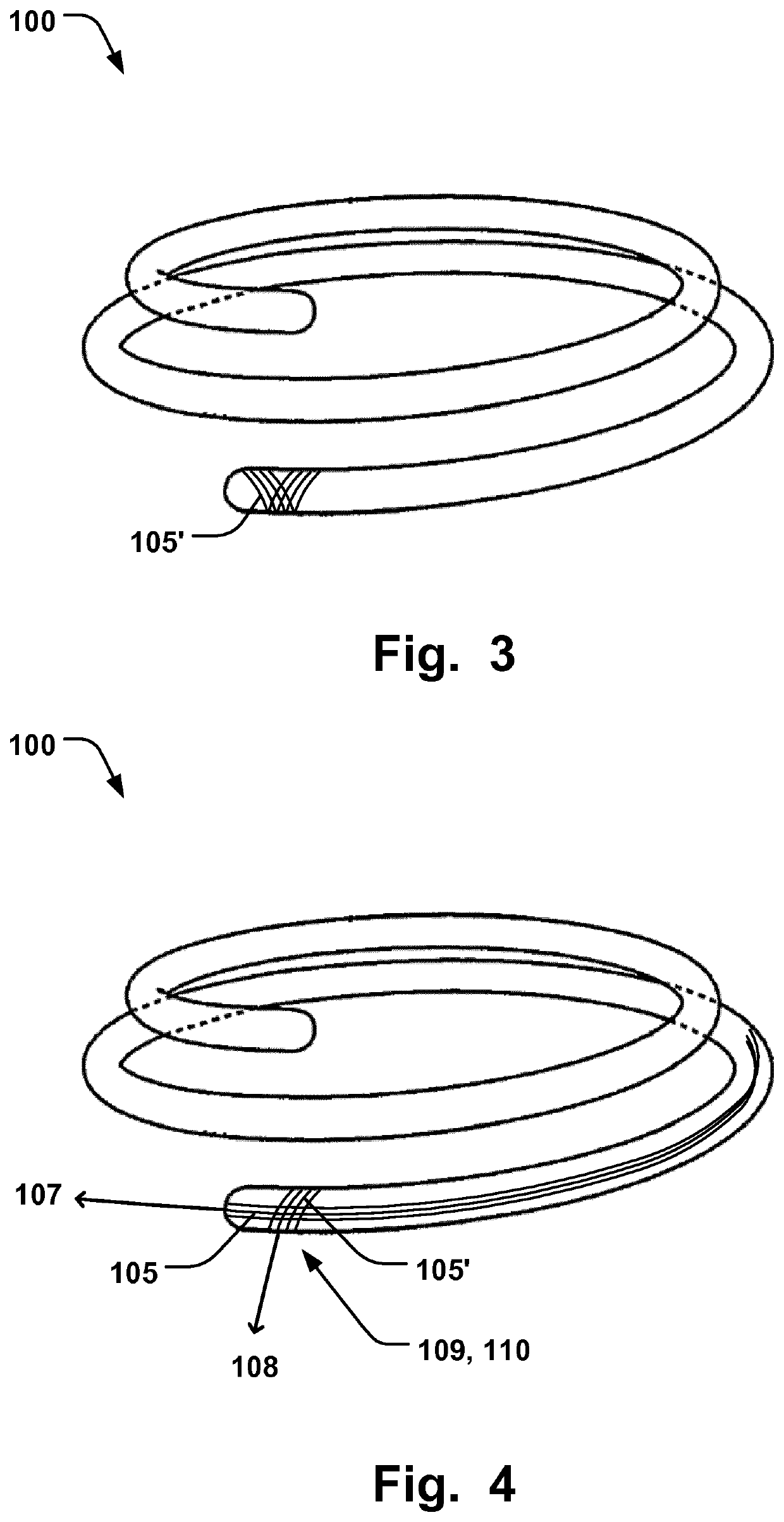 Annuloplasty implant