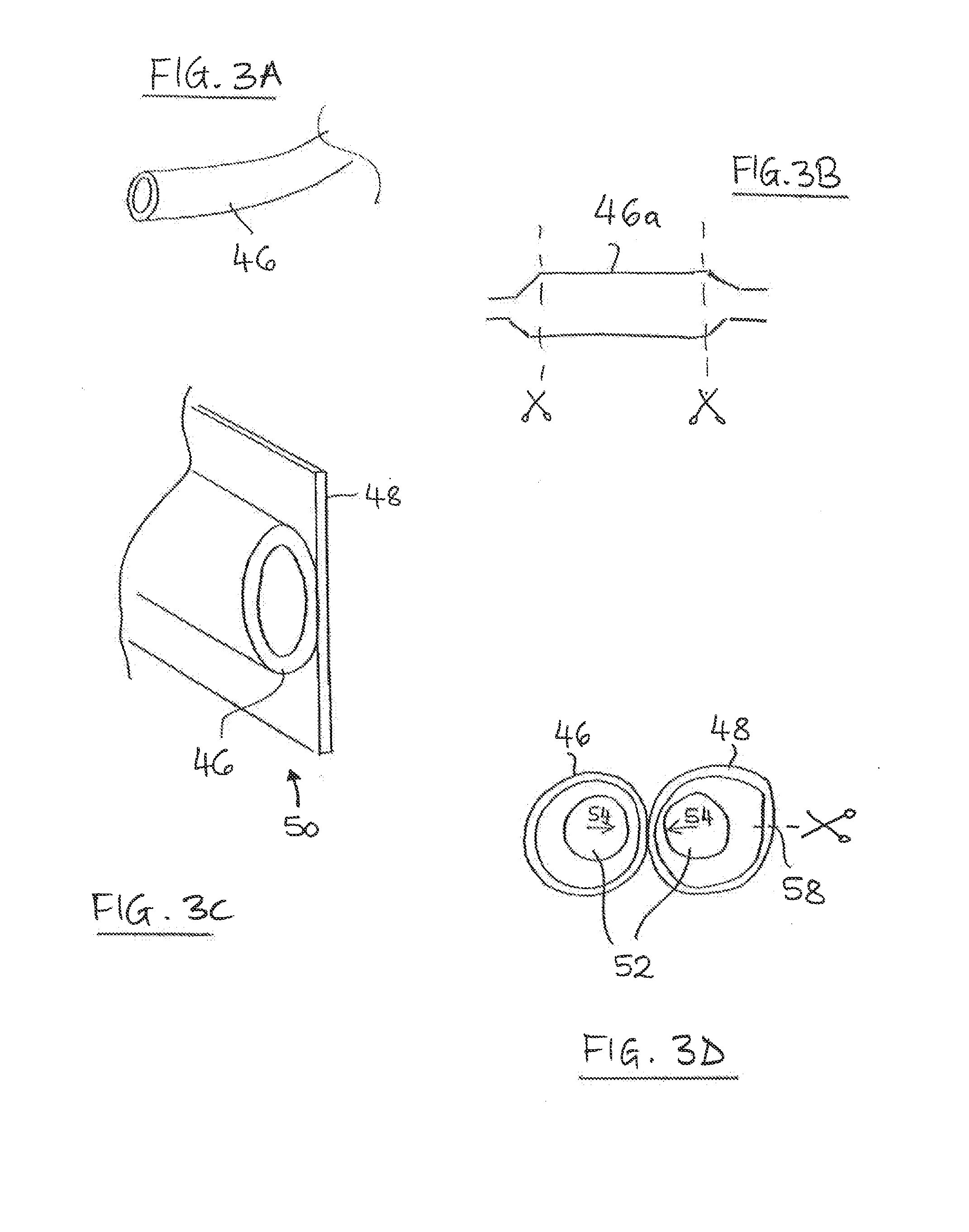 Prosthesis Seals and Methods for Sealing an Expandable Prosthesis
