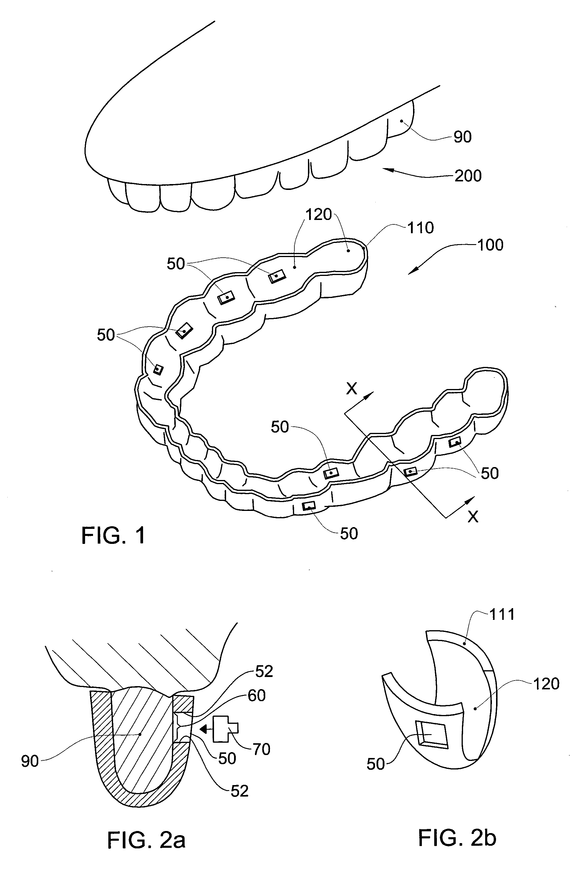 Dental targetting device and method