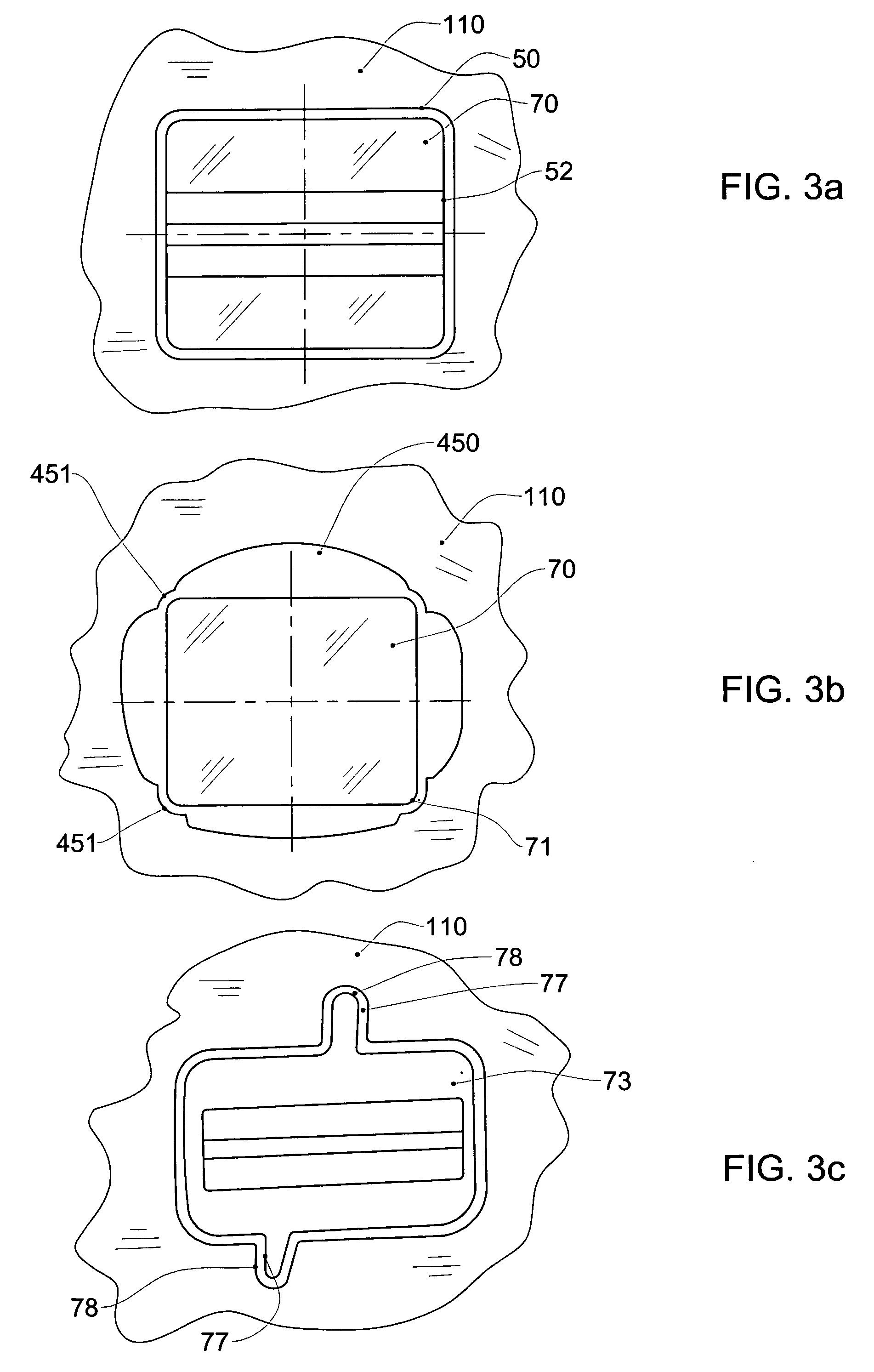 Dental targetting device and method