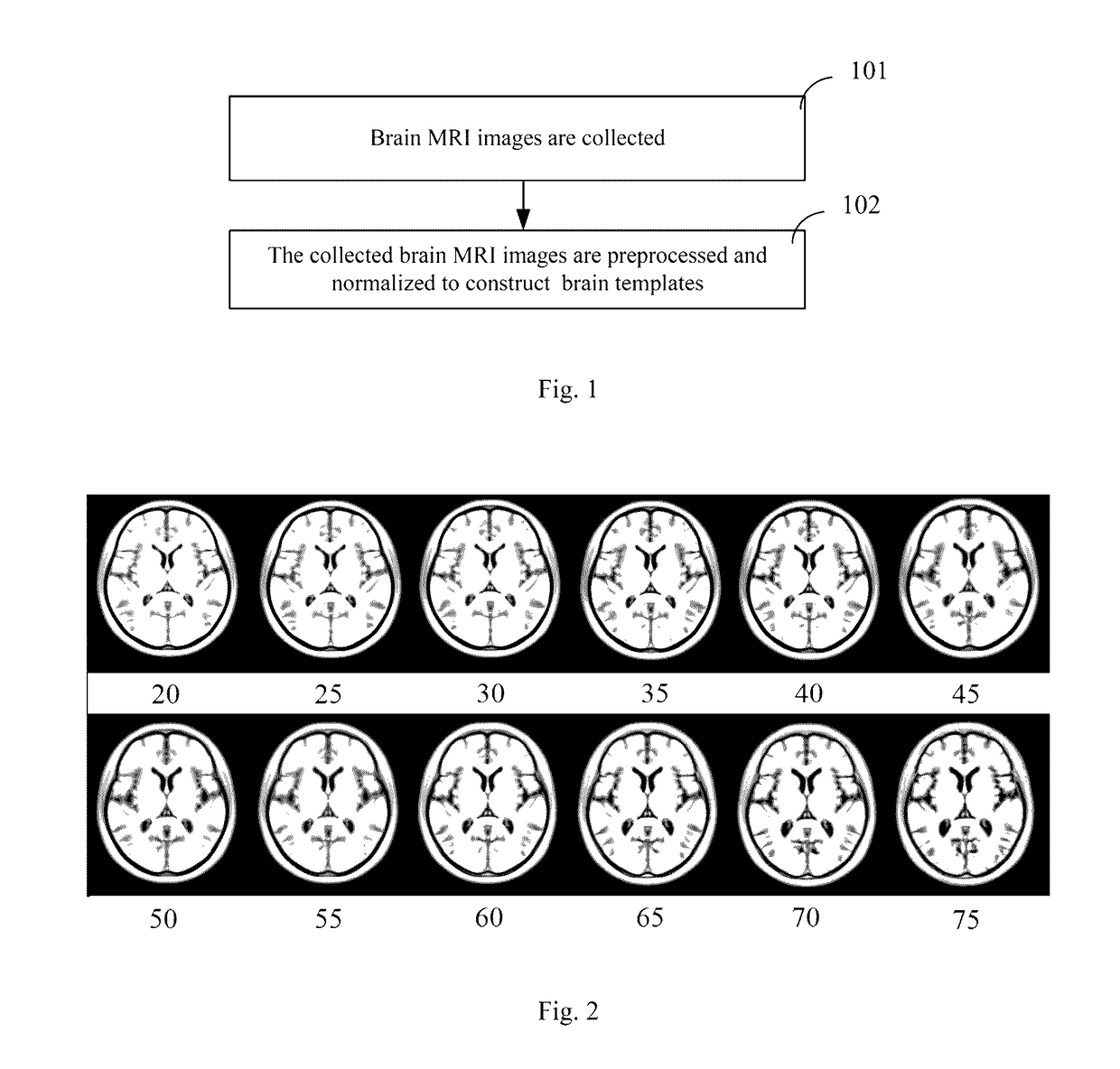Method and device for constructing brain templates
