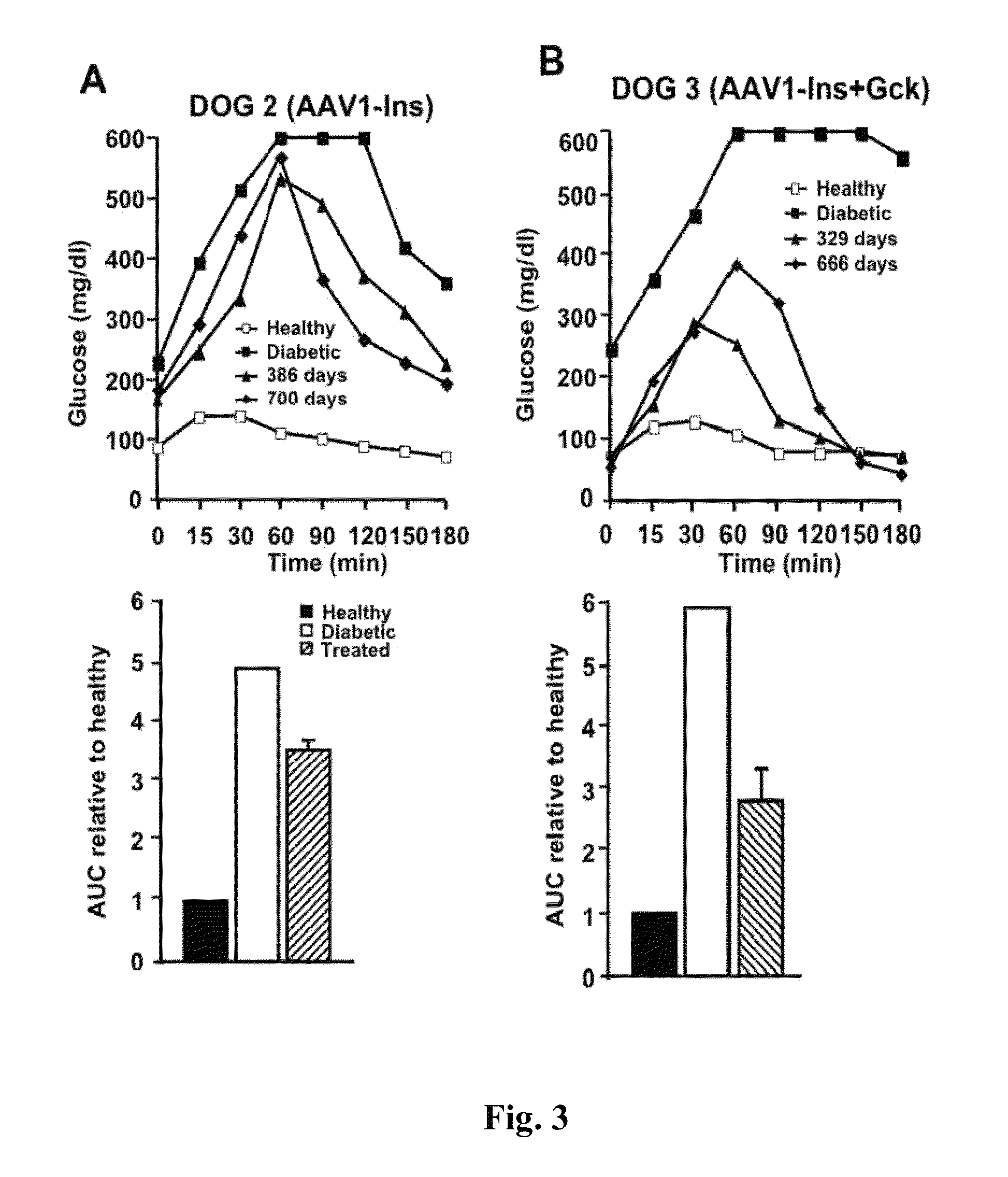 Gene therapy composition for use in diabetes treatment