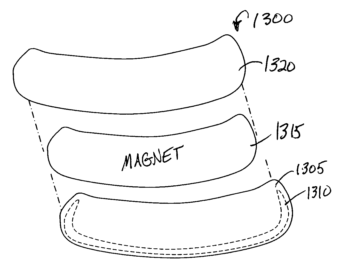 Apparatus and method for reducing vision problems as a result of floaters