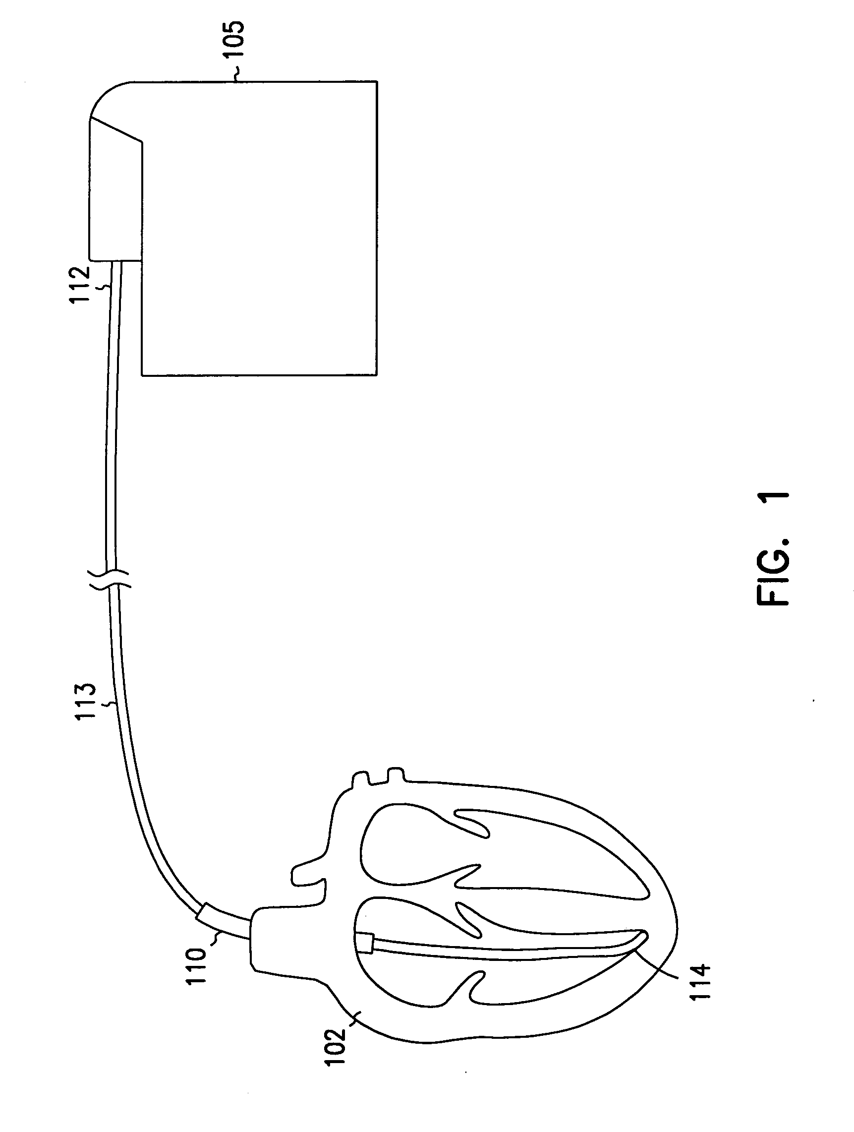 Extendable and retractable lead having a snap-fit terminal connector