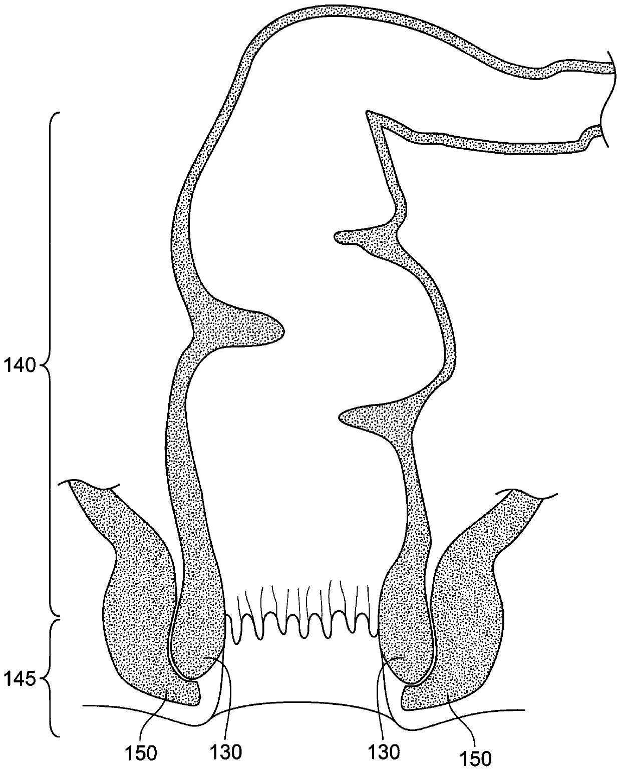 System and method for electrical stimulation of anorectal structures to treat urinary dysfunction