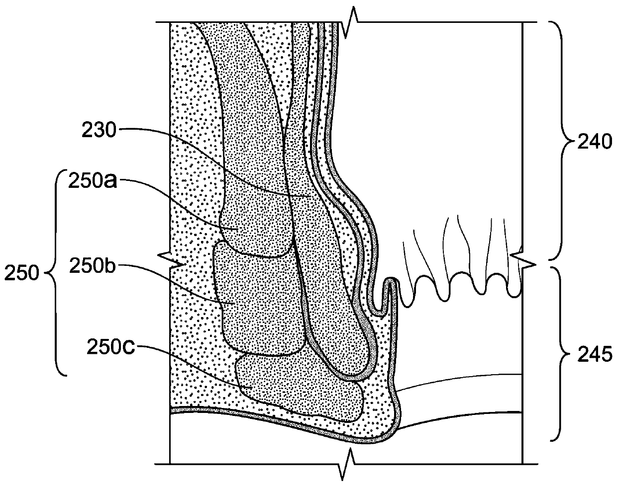 System and method for electrical stimulation of anorectal structures to treat urinary dysfunction