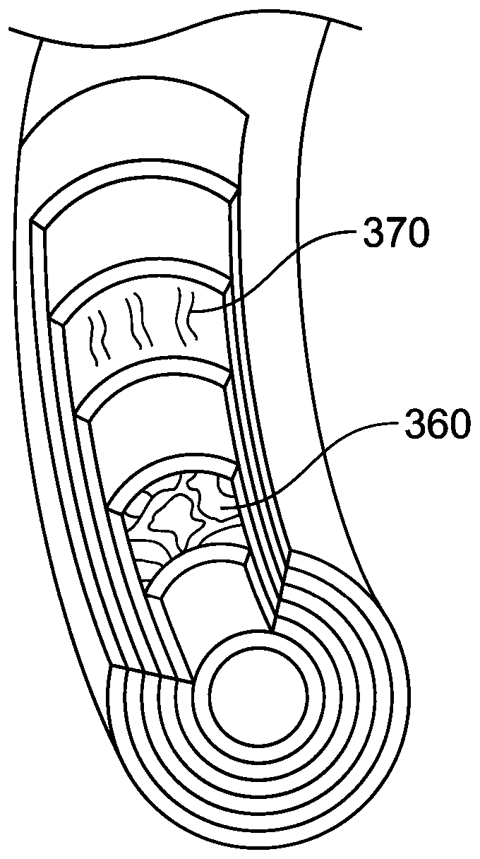 System and method for electrical stimulation of anorectal structures to treat urinary dysfunction