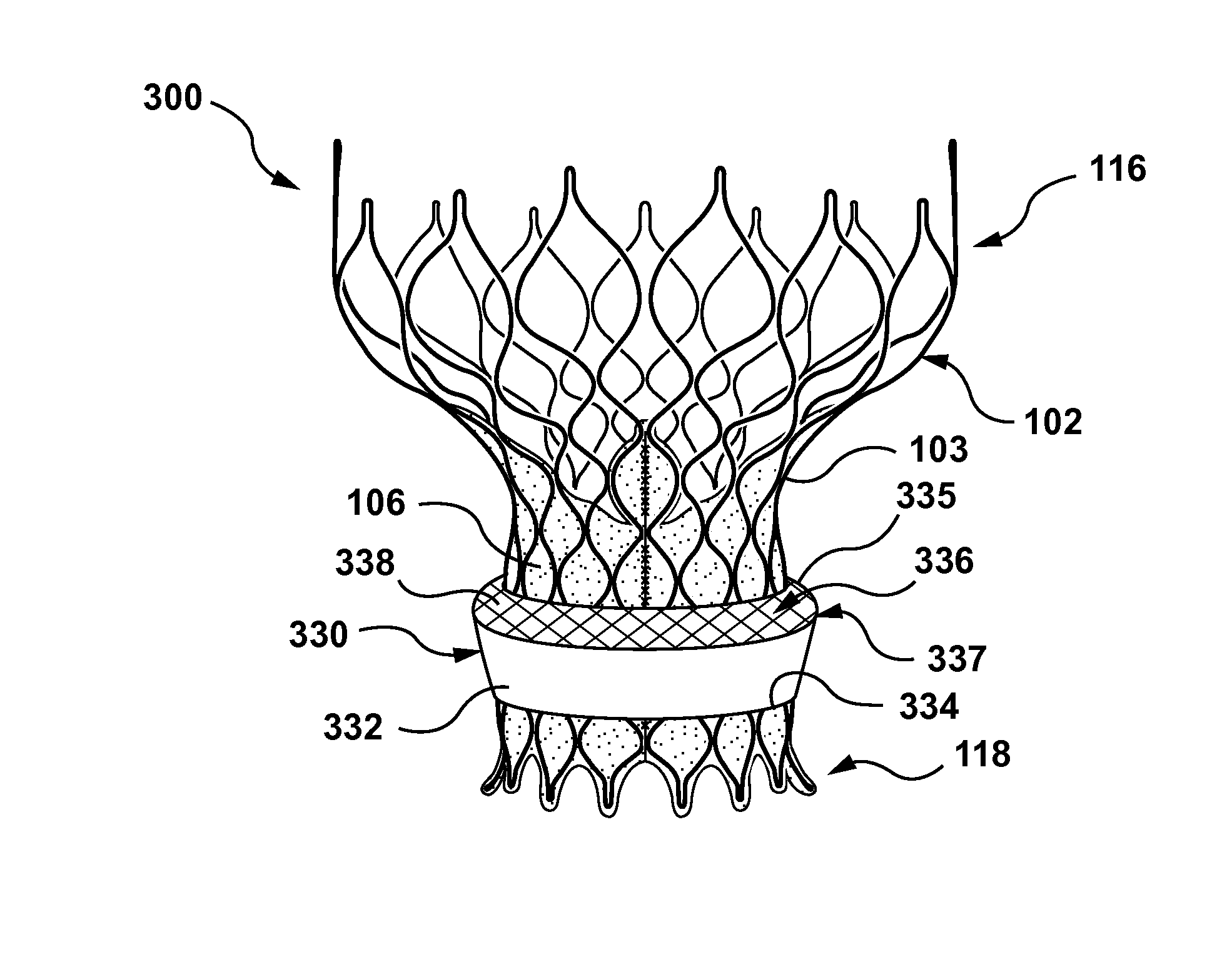Filtered sealing components for a transcatheter valve prosthesis