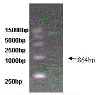 Echinococcus granulosus imago diagnosis protein gene and medical uses thereof