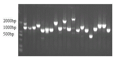 Echinococcus granulosus imago diagnosis protein gene and medical uses thereof