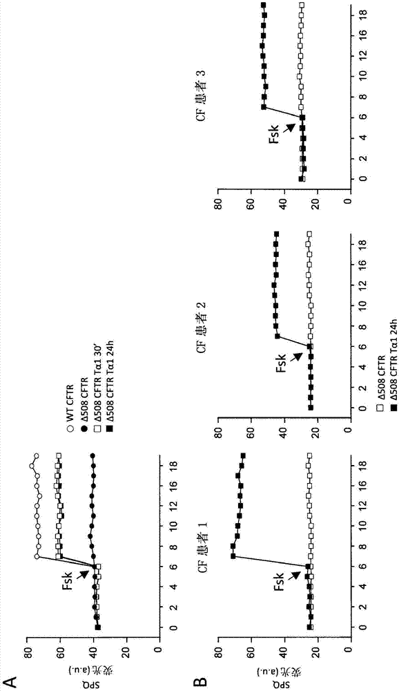 Thymosin alpha 1 for use in treatment of cystic fibrosis