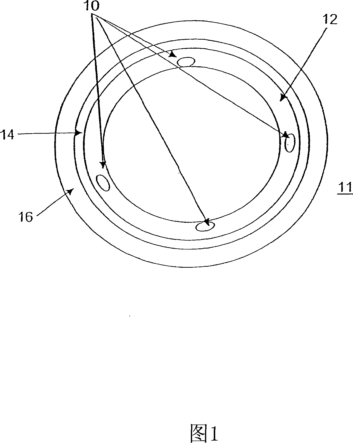 Bioactive bracket for type II diabetics and methods for use thereof