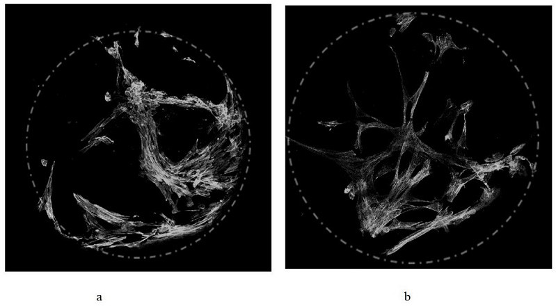 Preparation method of photocuring hydrogel microspheres capable of promoting angiogenesis