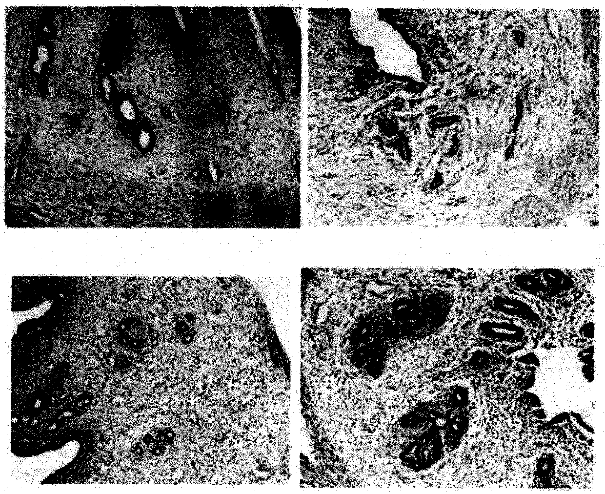 Establishment method of rat model of endometriosis with kidney deficiency and blood stasis syndrome