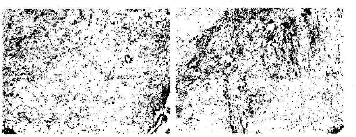 Establishment method of rat model of endometriosis with kidney deficiency and blood stasis syndrome