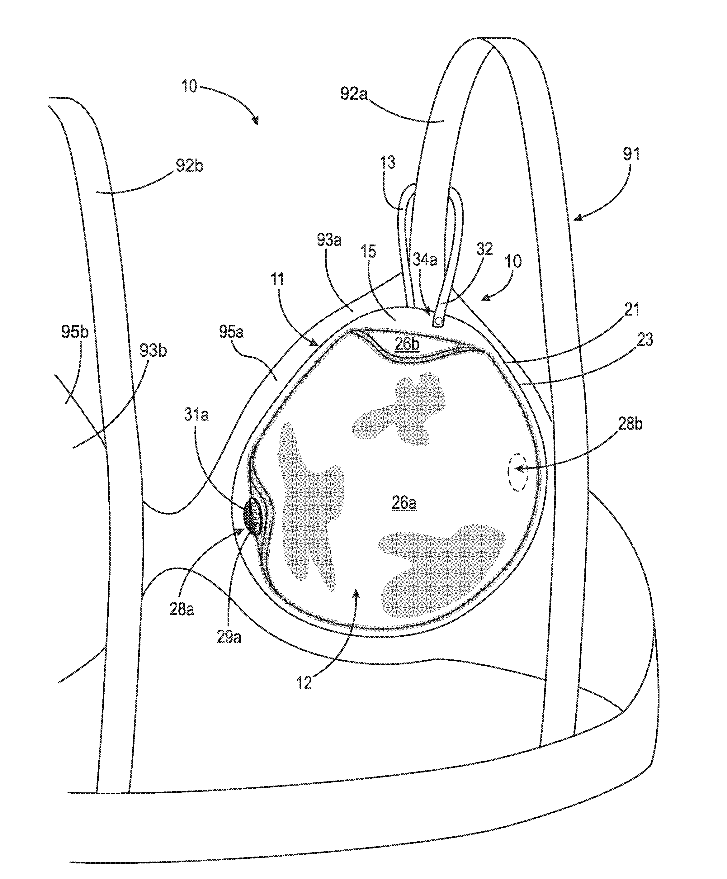 Thermal device for treating breastfeeding conditions