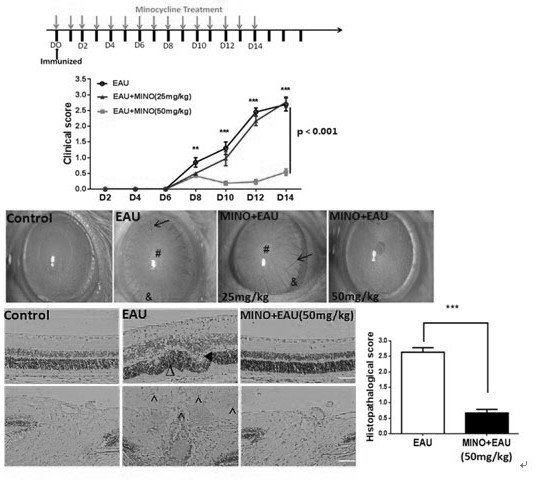 Application of minocycline hydrochloride to preparation of medicine for treating autoimmune uveitis and treatment method of autoimmune uveitis