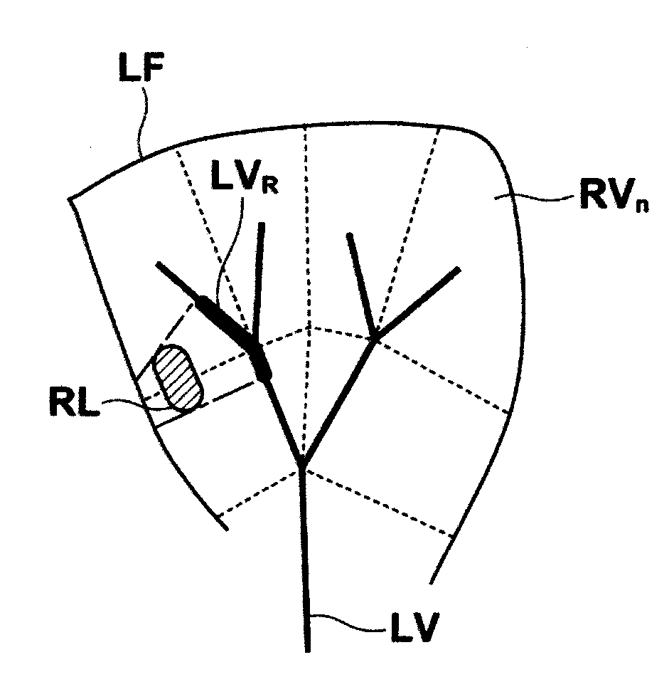 Medical image diagnosis assisting apparatus and method, and computer readable recording medium on which is recorded program for the same