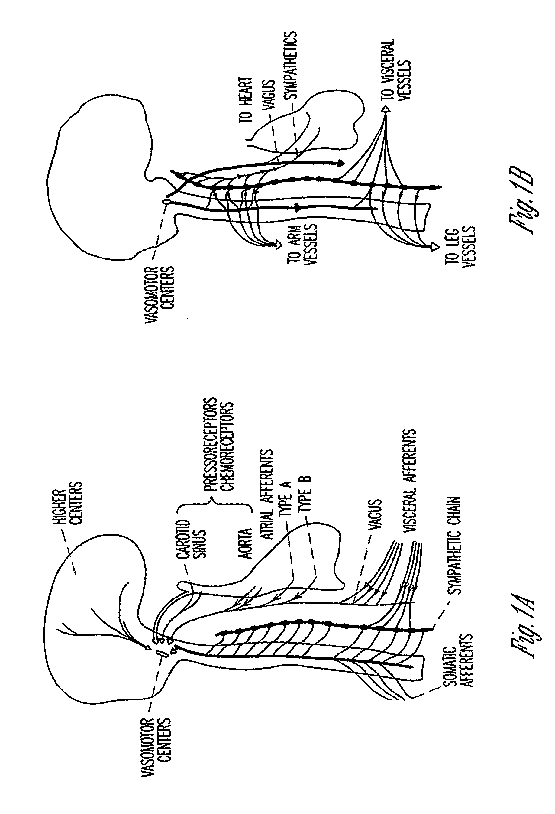 Adaptive baroreflex stimulation therapy for disordered breathing