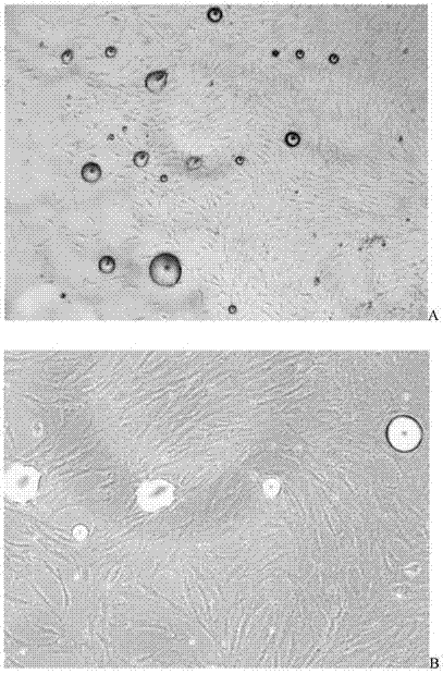 Autologous adipose-derived mesenchymal stem cell culture method and used culture medium