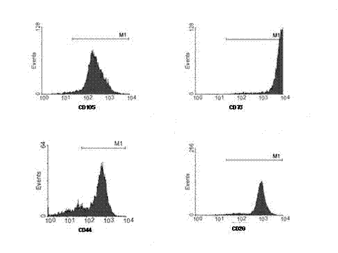 Method for inducing umbilical cord mesenchymal stem cells to differentiate into endothelial cells
