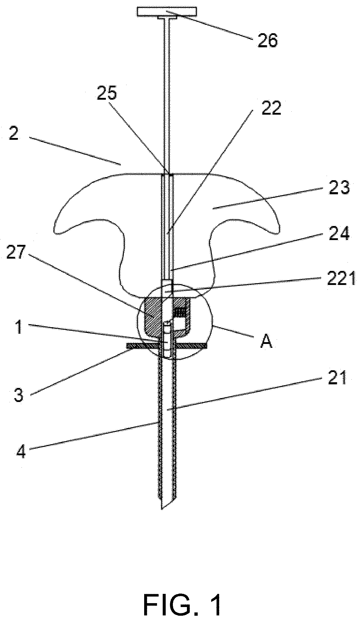 Removable dual gold marker implantation device with minor damage and using method thereof