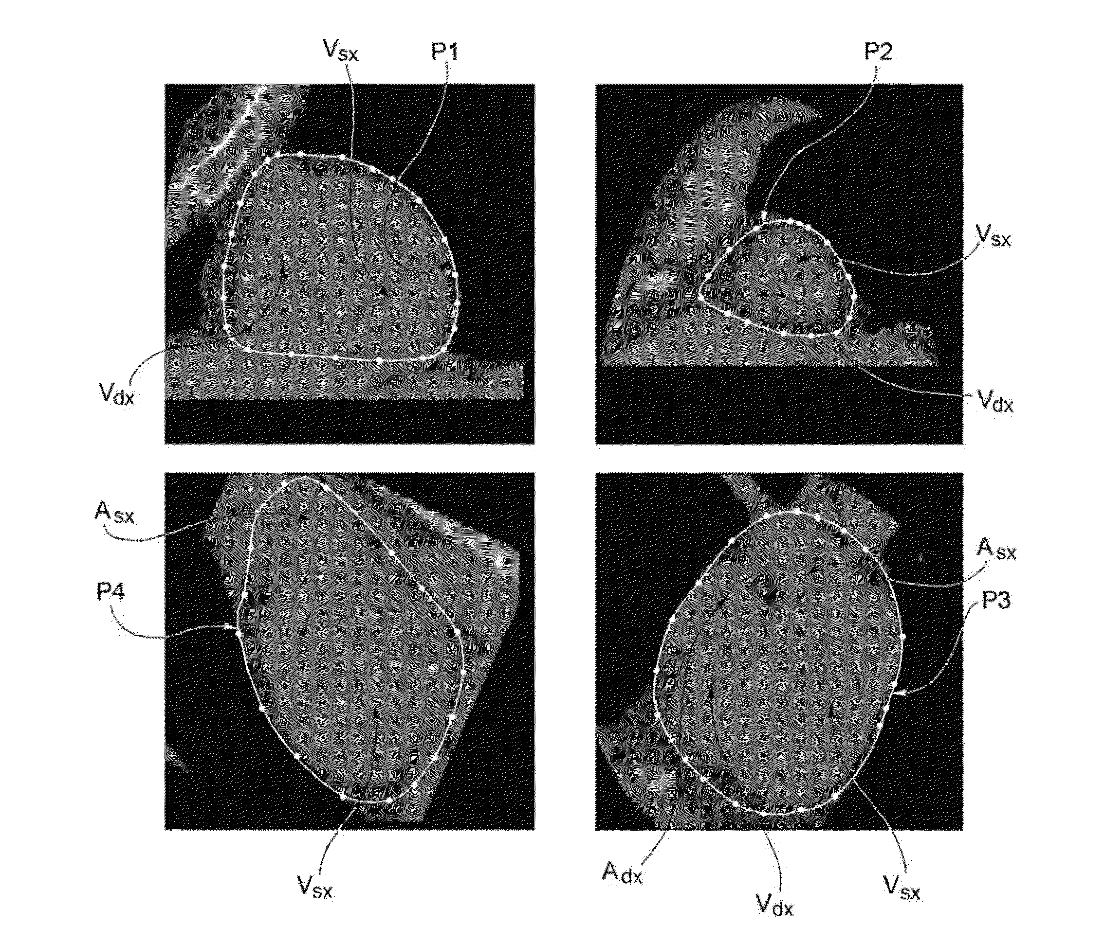 Methods and systems for determining the volume of epicardial fat from volumetric images