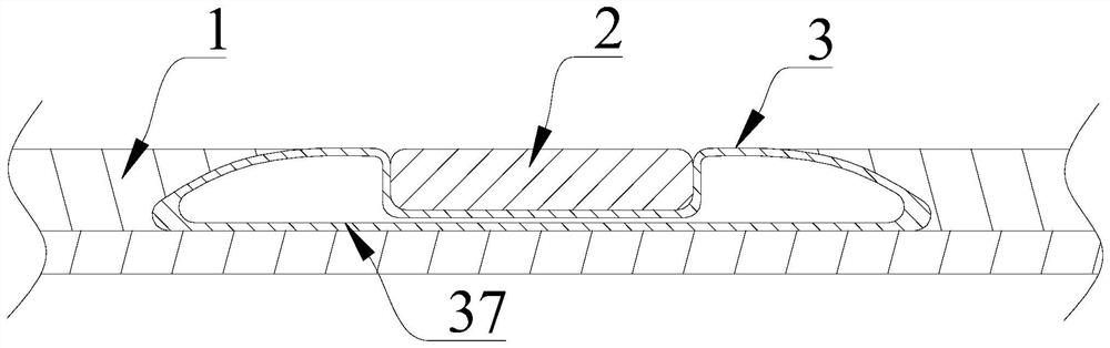 Twelve-lead wearable device based on regional distribution