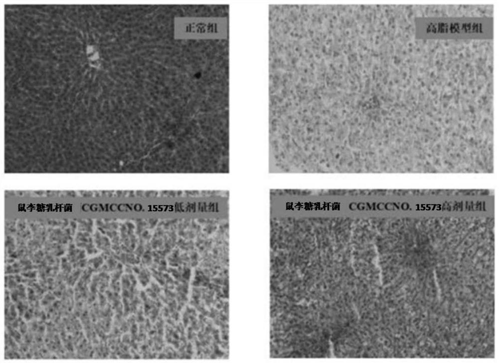 Application of Lactobacillus rhamnosus in the preparation of a composition with the effect of inhibiting fatty liver disease