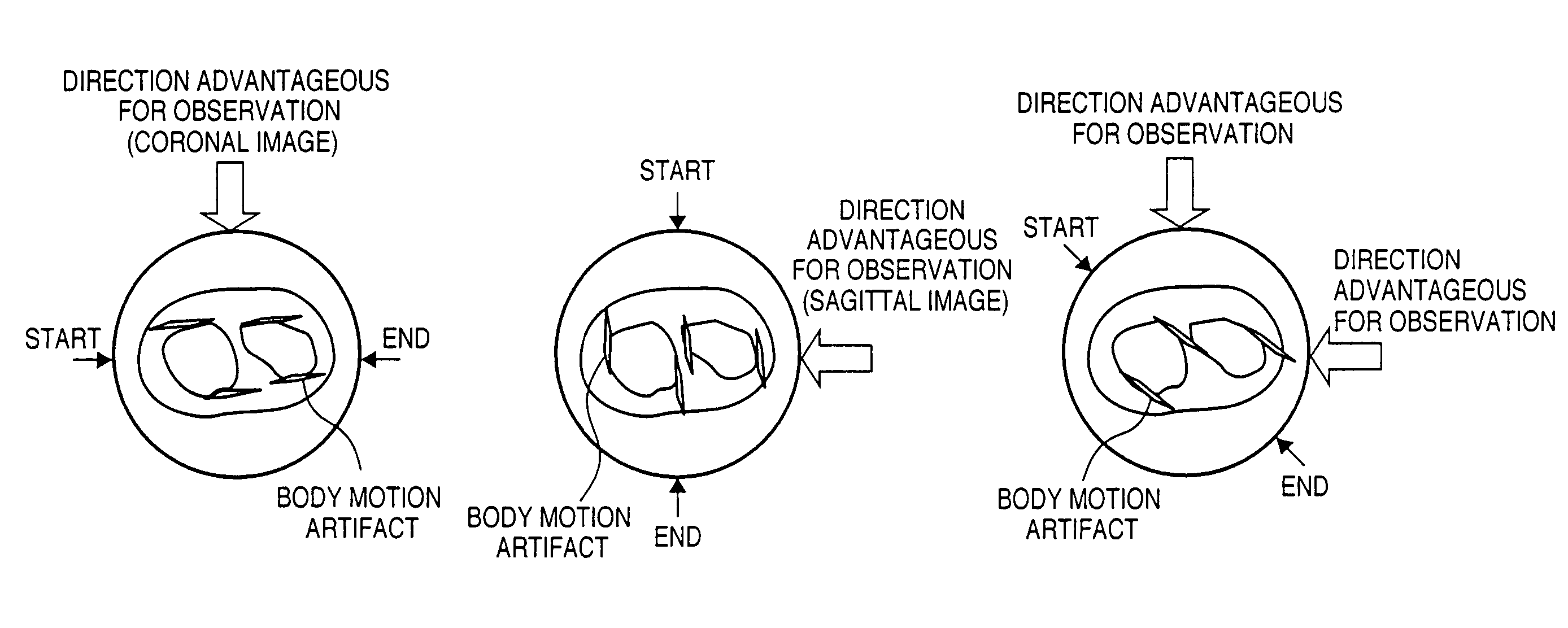 X-ray imaging apparatus and its control method