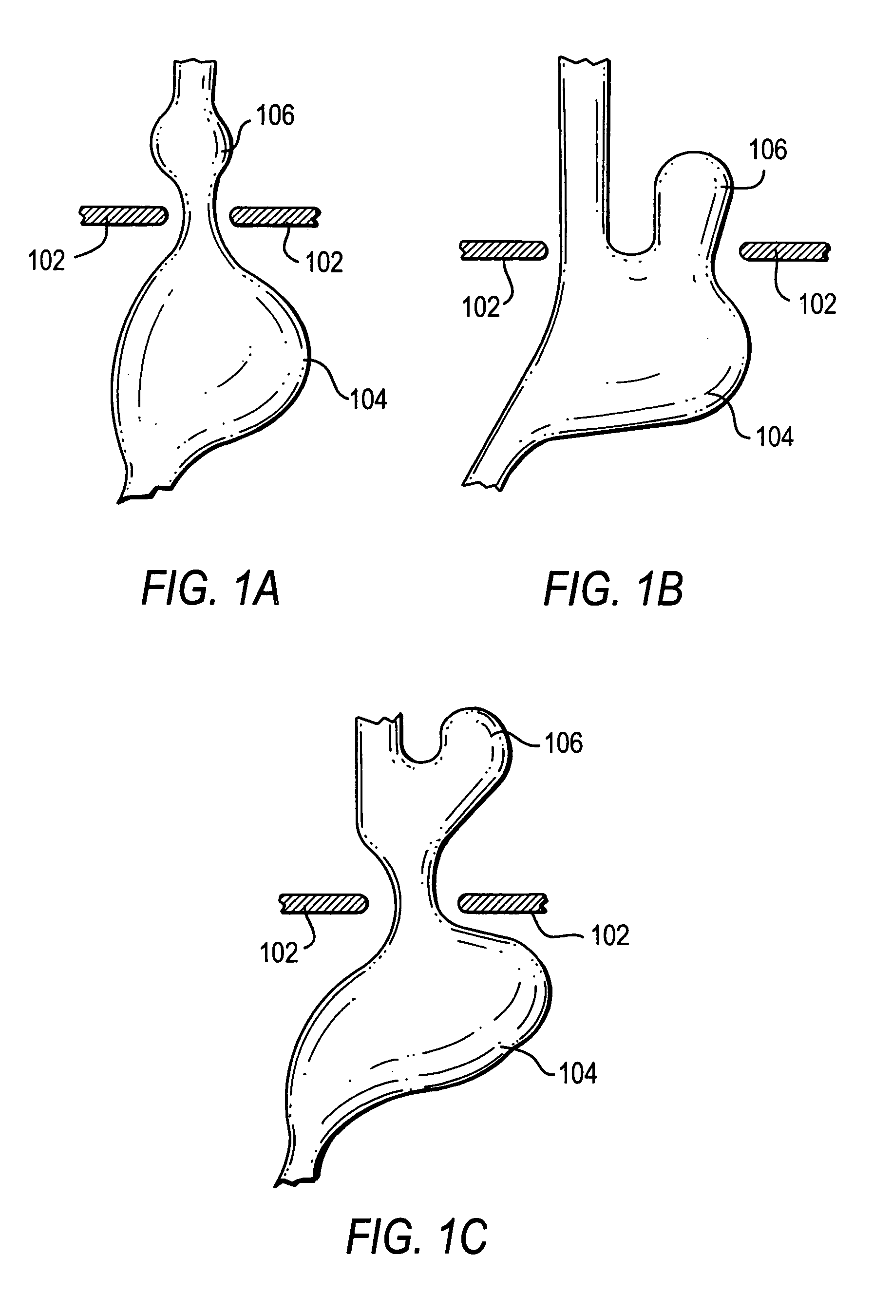 Methods and apparatus for improving the function of biological passages