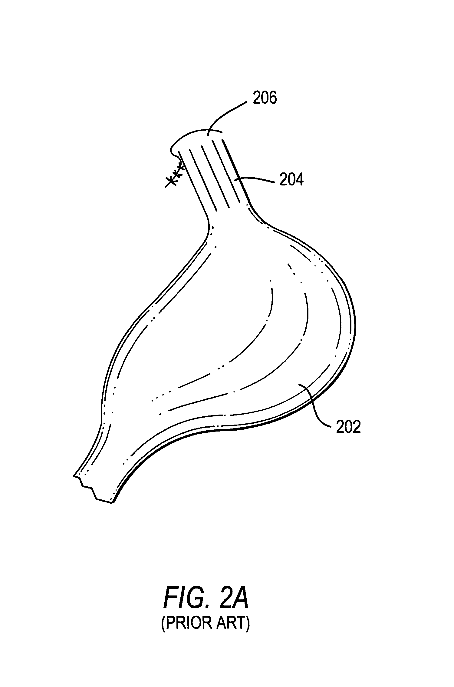 Methods and apparatus for improving the function of biological passages