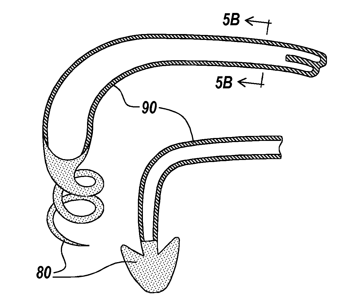 Implantable Medical Devices, Methods of Use, and Apparatus for Extraction Thereof