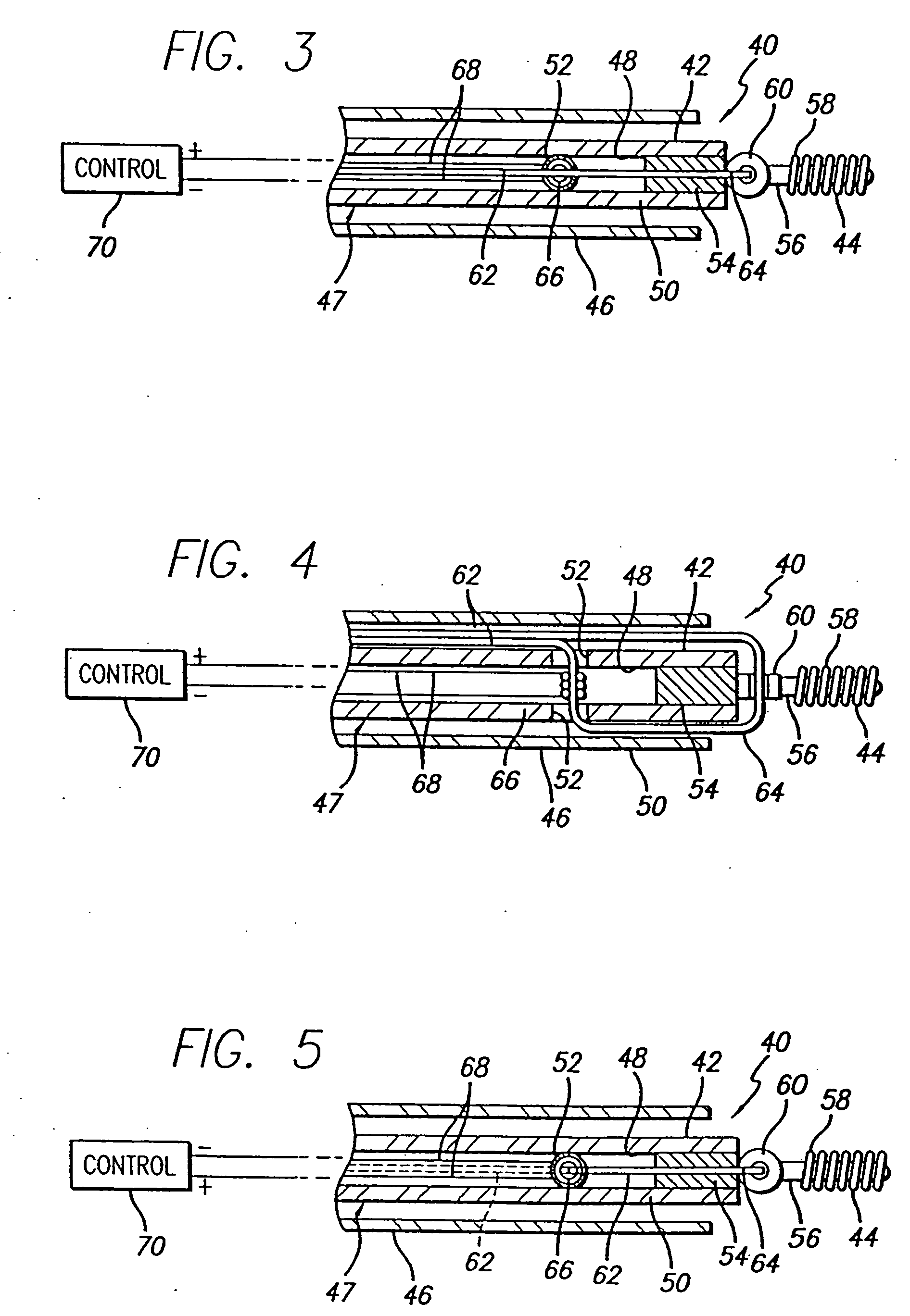 Apparatus for deployment of micro-coil using a catheter