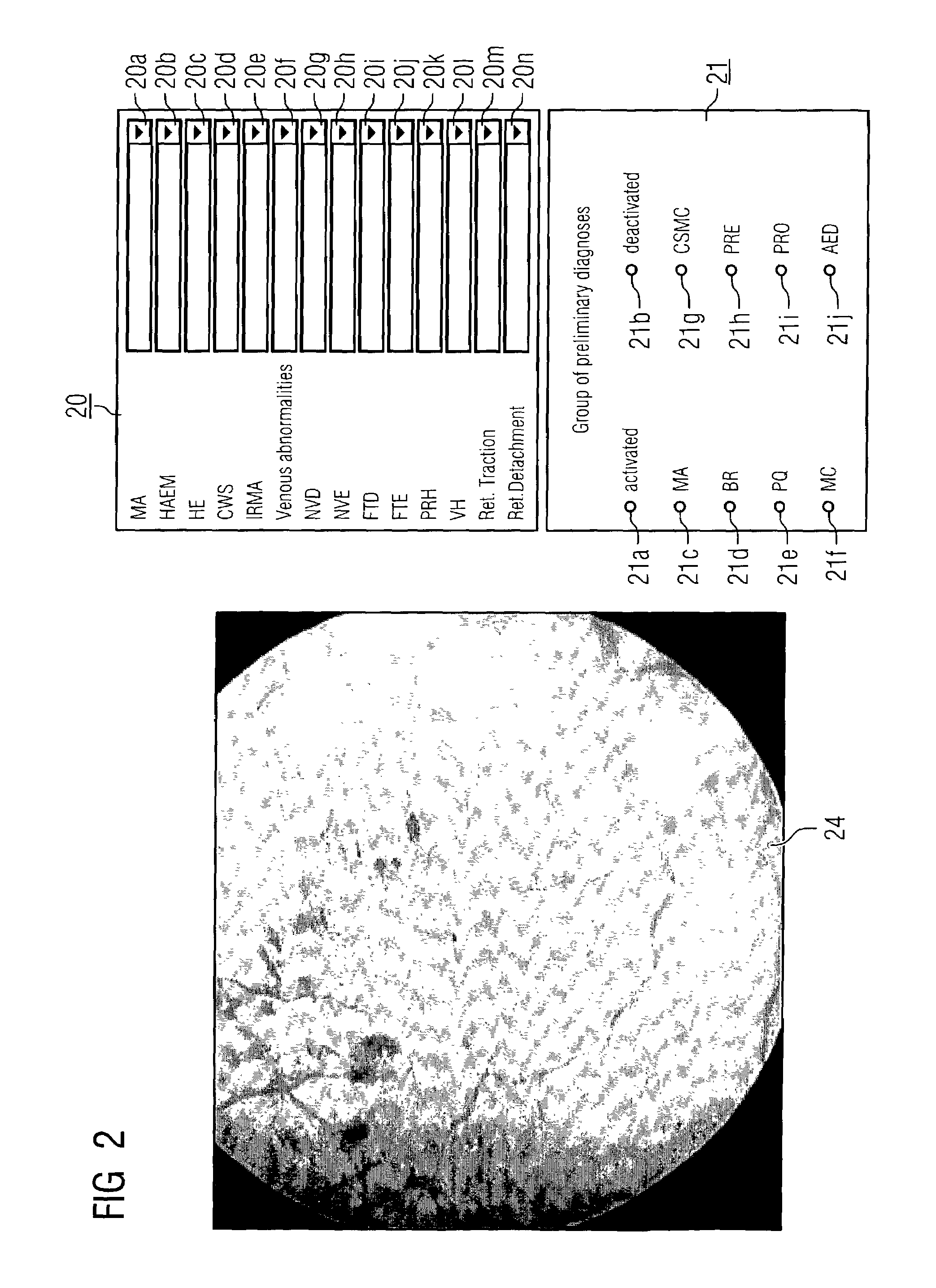 Method and system for supporting the evaluation of a picture of an eye
