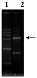 A strain of recombinant Pichia pastoris expressing Rhizomucor miehei lipase heterologously and efficiently and its application