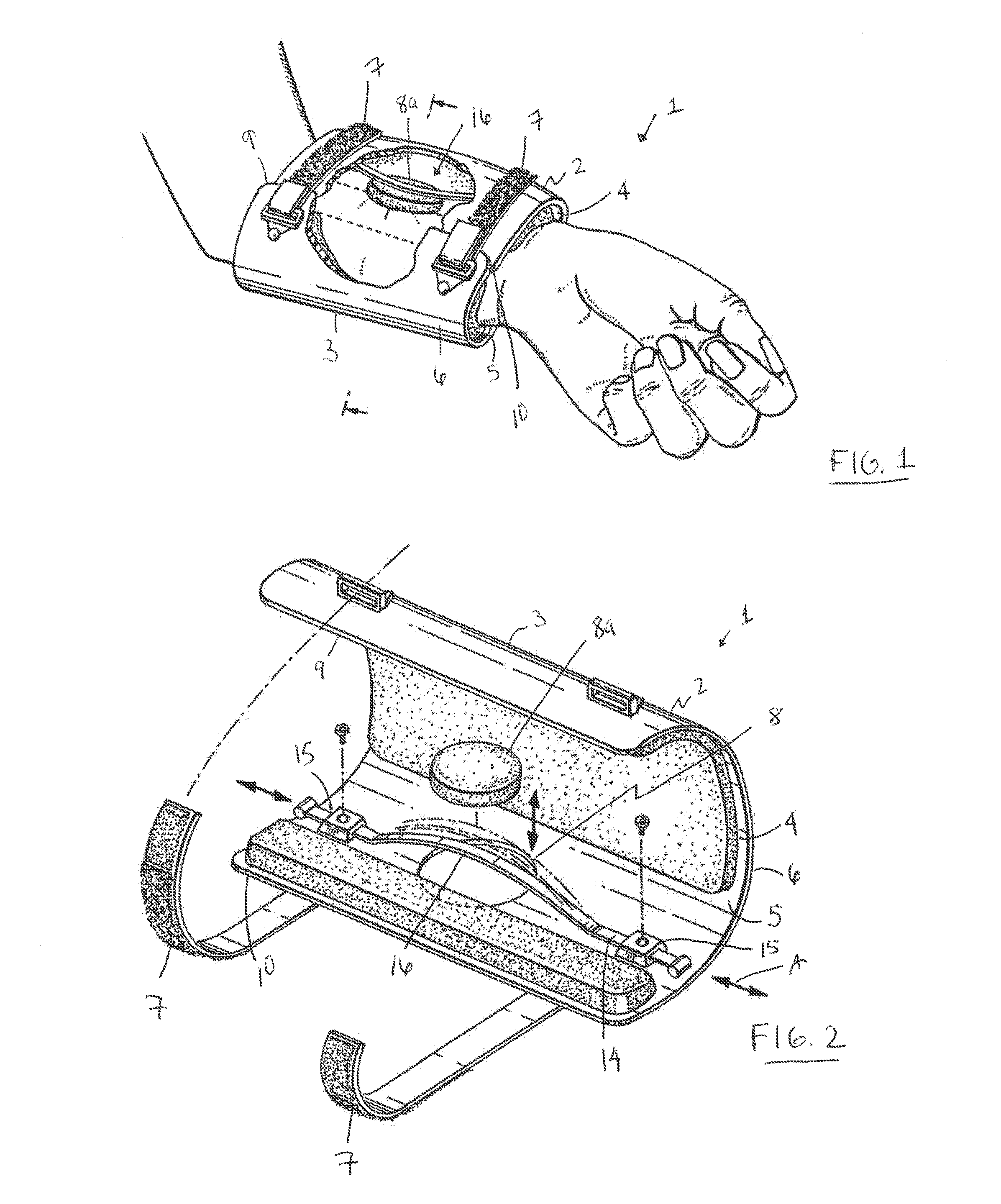 Orthopaedic device and method of use for treating bone fractures