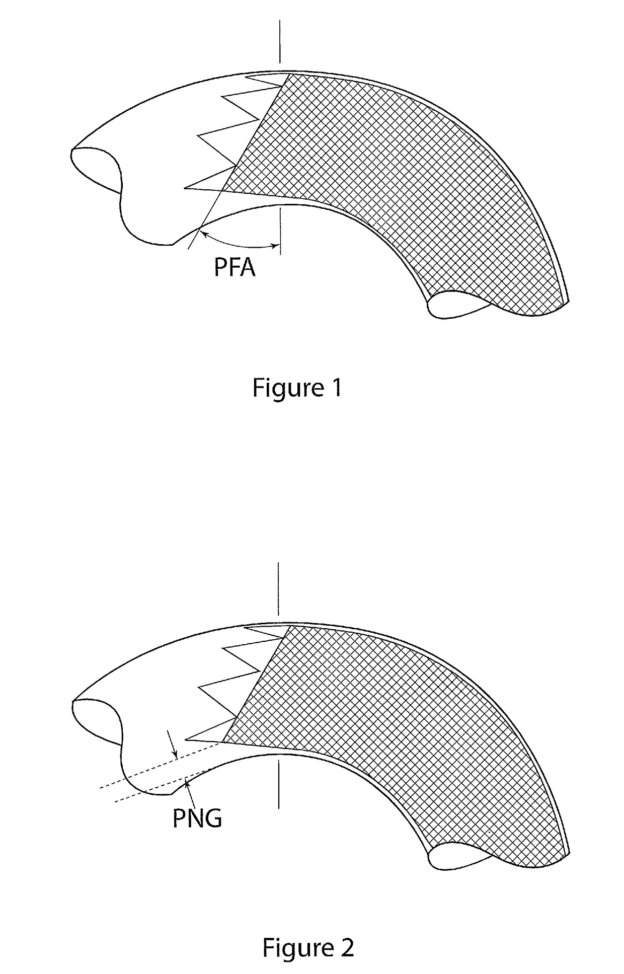 Introducer for deploying a stent graft in a curved lumen and stent graft therefor